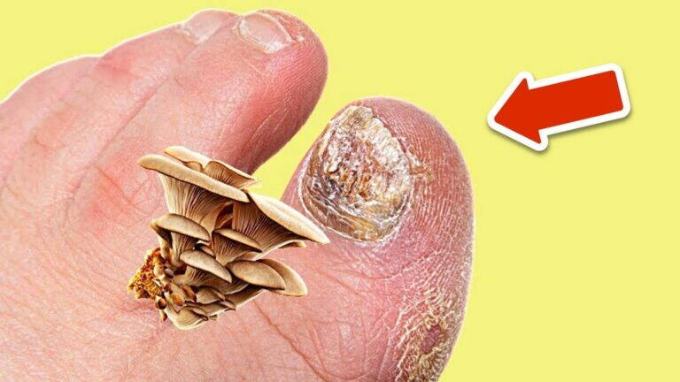 10 skutecznych sposobów na trwałe pozbycie się grzyba w domu!